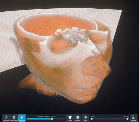 Виртуальный учебный комплекс «Интерактивный трехмерный атлас анатомии человека»
