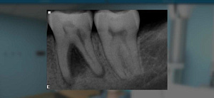 Виртуальный учебный комплекс «Строение зубов человека»